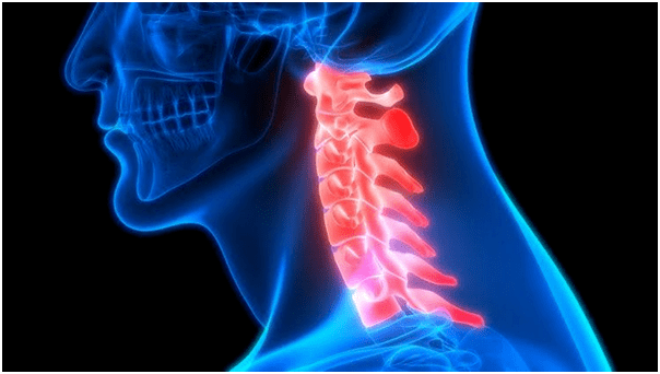 Sakit leher membawa kepada sakit belakang