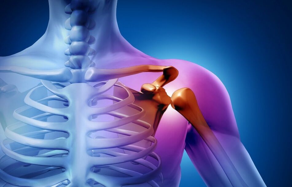 Kecederaan sendi bahu akibat osteoarthritis