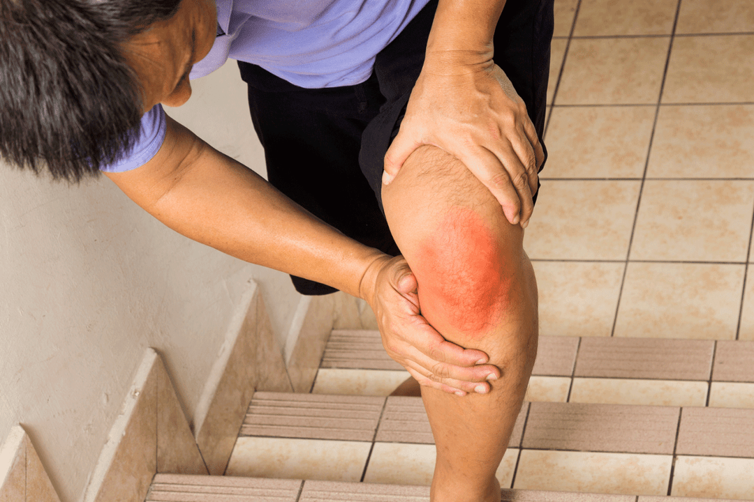 Sakit sendi akibat osteoarthritis