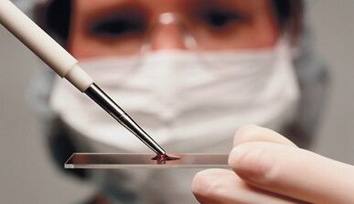 Diagnosis pembezaan atribut dan osteoarthritis