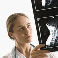 Diagnosis osteochondrosis ditentukan menggunakan peperiksaan rasuk x
