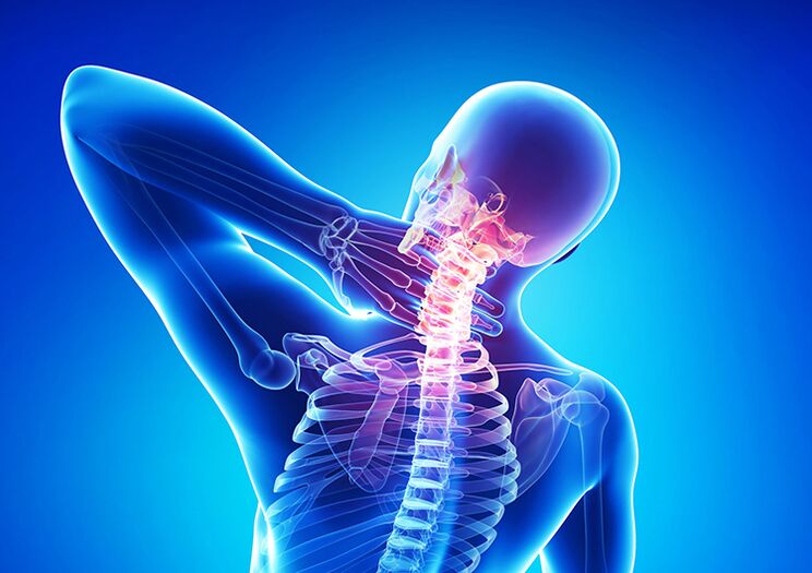 Osteochondrosis tulang belakang adalah penyakit yang menjejaskan rawan artikular dan vertebra.